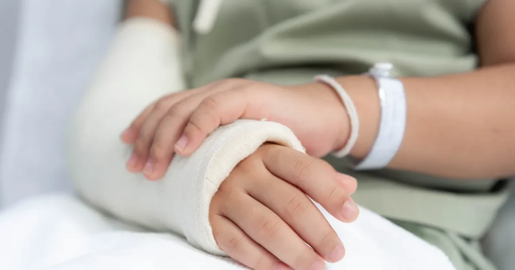Injured arm cast